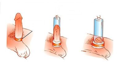 The principle of pump function to increase the penis