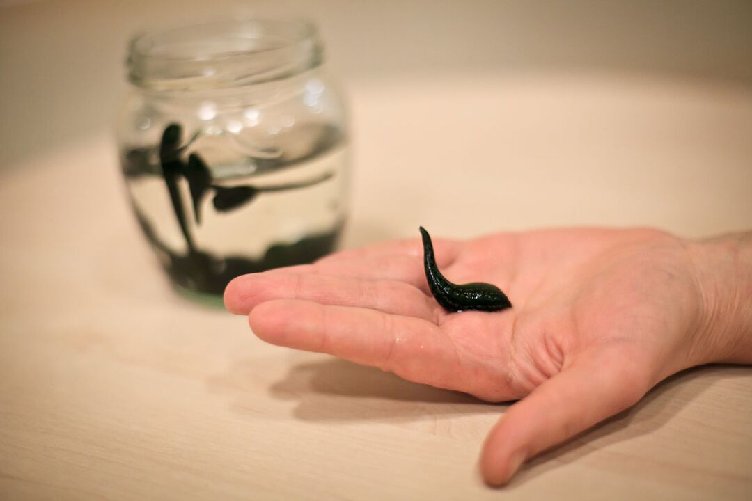 The leeches will serve as raw material for the production of the cream that stimulates the growth of the penis